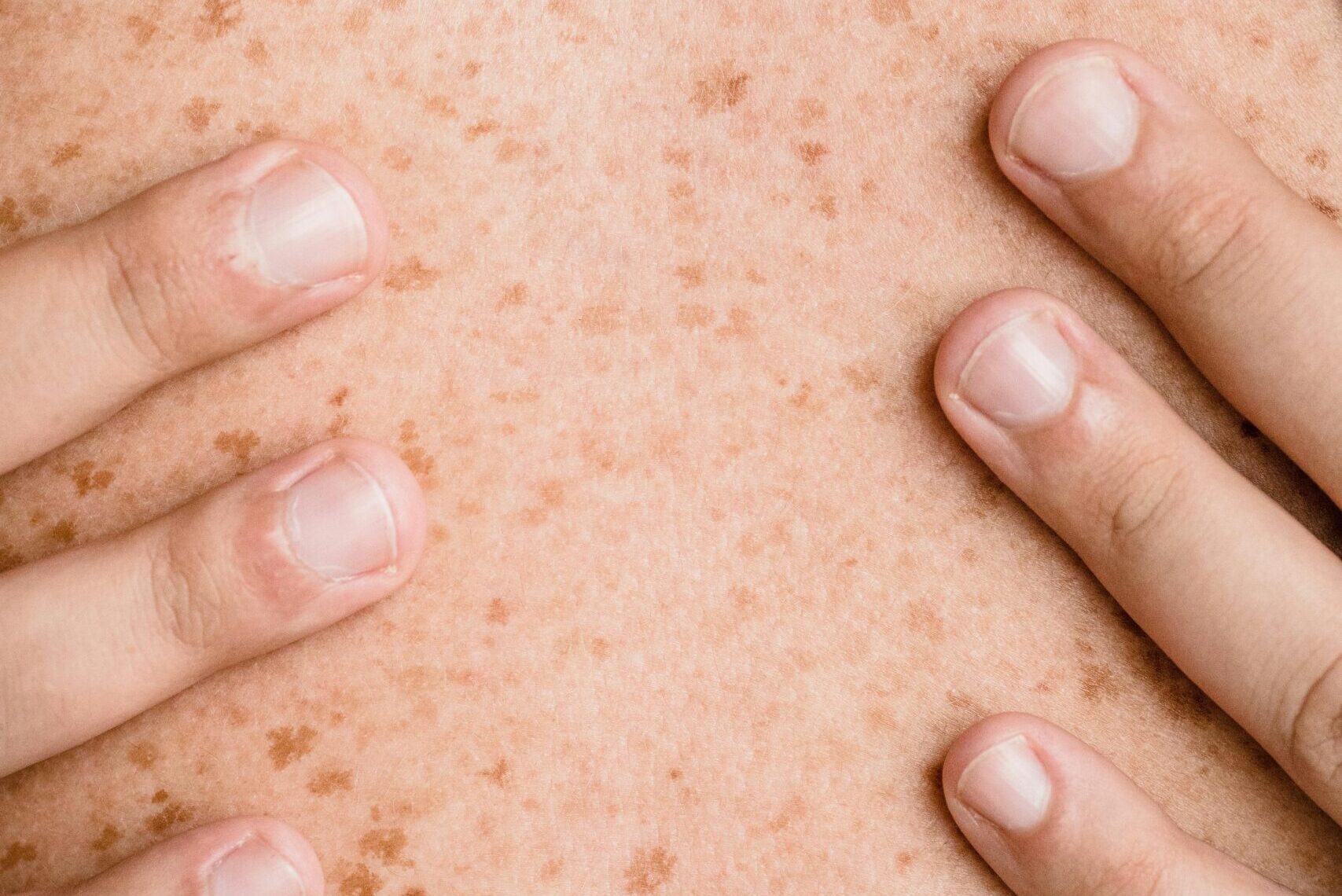 El Desnudo Detrás de Cámaras